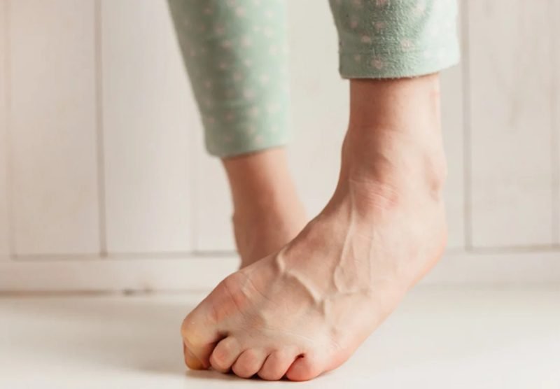 Woman hiding her feet due to toenail fungus