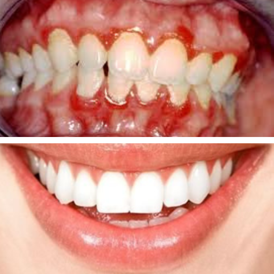 Prodentim Reviews 2025 before and after teeth - WisePickGuide | Supplement Reviews & Health Product Insights